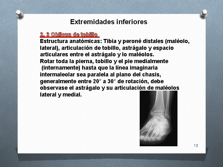Extremidades inferiores 2. 3 Oblicua de tobillo Estructura anatómicas: Tibia y peroné distales (maléolo, Extremidades inferiores 2. 3 Oblicua de tobillo Estructura anatómicas: Tibia y peroné distales (maléolo,