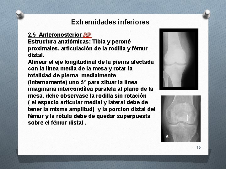Extremidades inferiores 2. 5 Anteroposterior AP Estructura anatómicas: Tibia y peroné proximales, articulación de