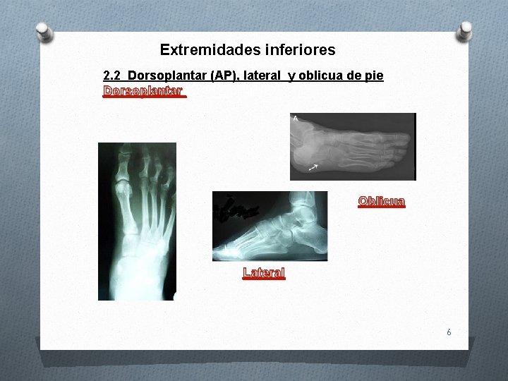 Extremidades inferiores 2. 2 Dorsoplantar (AP), lateral y oblicua de pie Dorsoplantar Oblicua Lateral