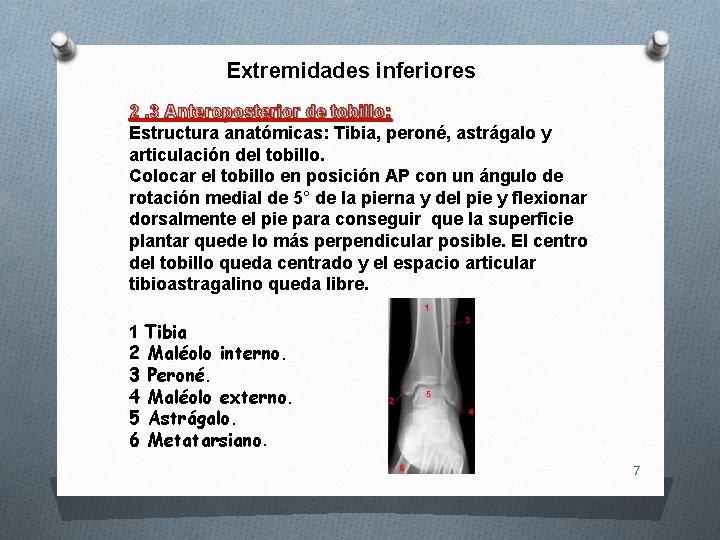 Extremidades inferiores 2. 3 Anteroposterior de tobillo: Estructura anatómicas: Tibia, peroné, astrágalo y articulación