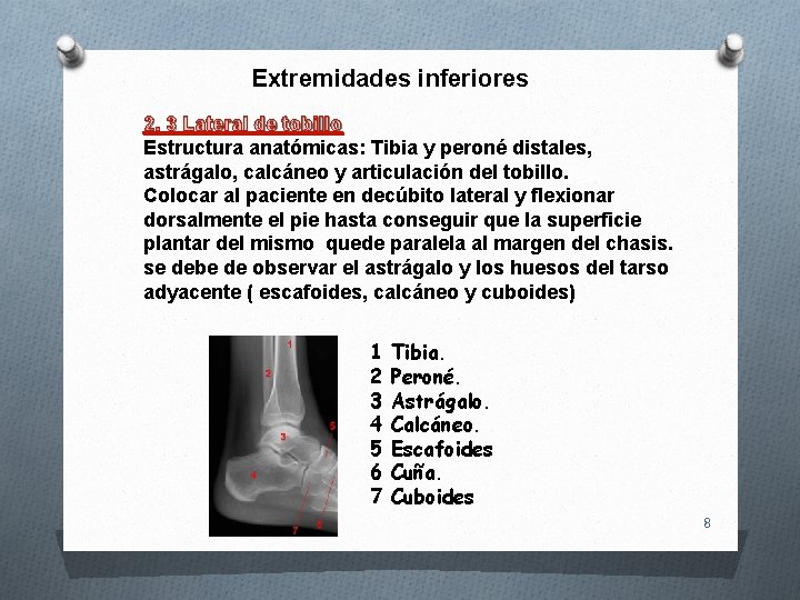 Extremidades inferiores 2. 3 Lateral de tobillo Estructura anatómicas: Tibia y peroné distales, astrágalo,