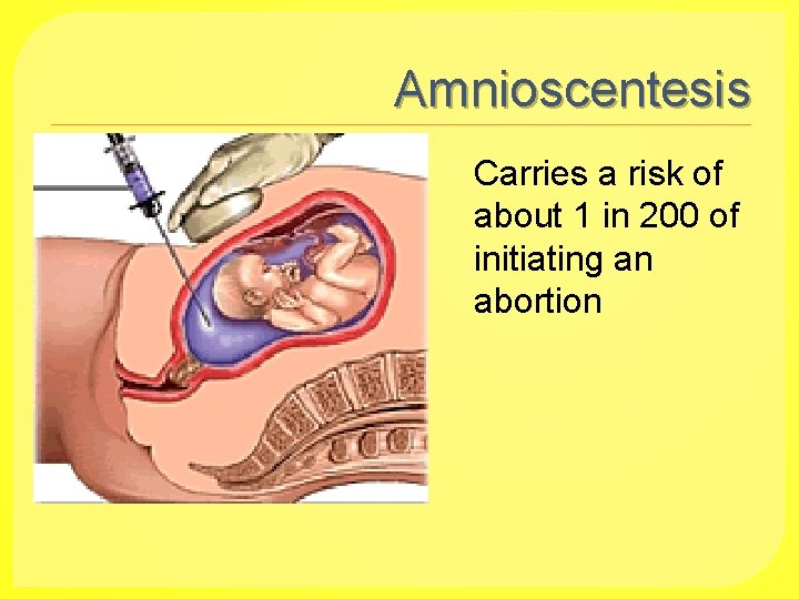 Amnioscentesis Carries a risk of about 1 in 200 of initiating an abortion 