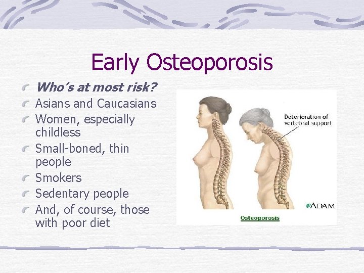 Early Osteoporosis Who’s at most risk? Asians and Caucasians Women, especially childless Small-boned, thin
