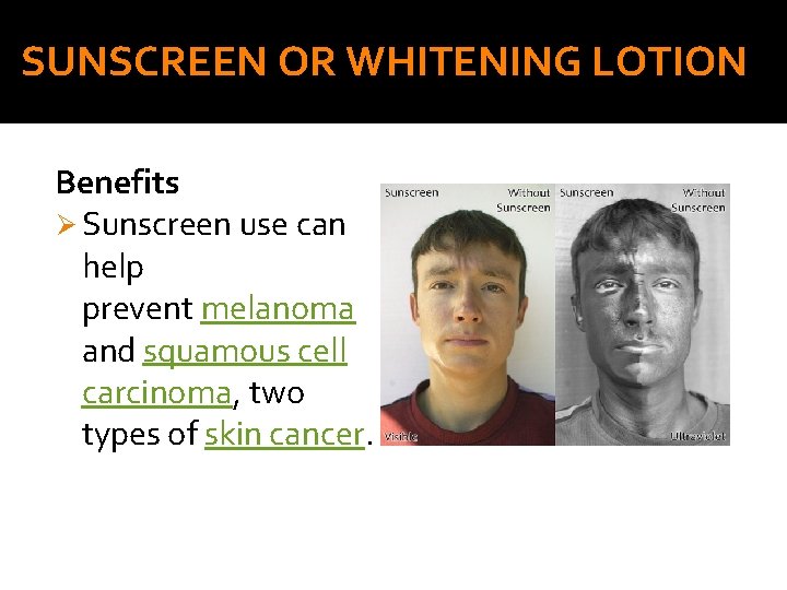 SUNSCREEN OR WHITENING LOTION Benefits Ø Sunscreen use can help prevent melanoma and squamous