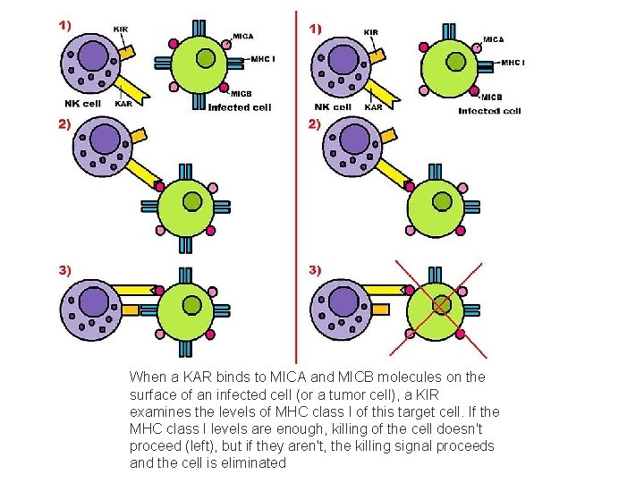 When a KAR binds to MICA and MICB molecules on the surface of an