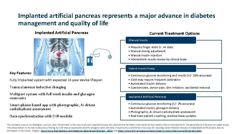 Implanted artificial pancreas represents a major advance in diabetes management and quality of life