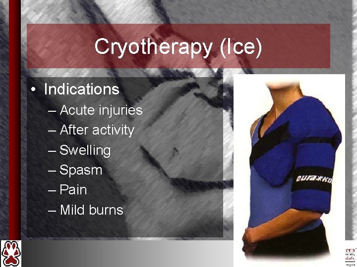 Cryotherapy (Ice) • Indications – Acute injuries – After activity – Swelling – Spasm