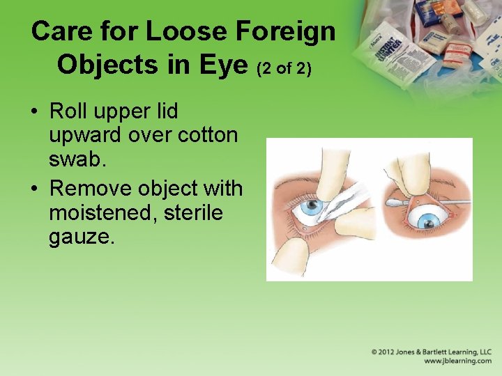 Care for Loose Foreign Objects in Eye (2 of 2) • Roll upper lid