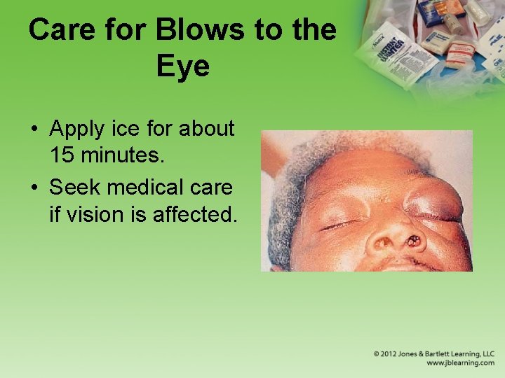 Care for Blows to the Eye • Apply ice for about 15 minutes. •
