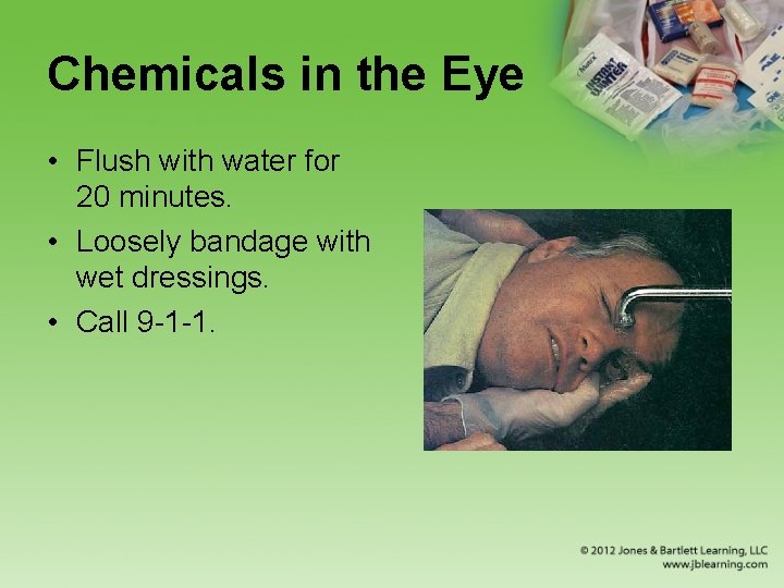 Chemicals in the Eye • Flush with water for 20 minutes. • Loosely bandage