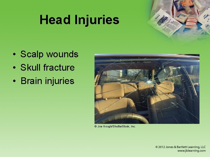 Head Injuries • Scalp wounds • Skull fracture • Brain injuries © Joe Gough/Shutter.