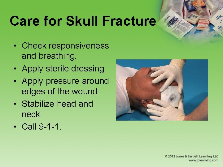 Care for Skull Fracture • Check responsiveness and breathing. • Apply sterile dressing. •