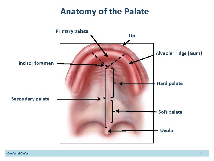 Anatomy of the Palate Primary palate Lip Alveolar ridge (Gum) Incisor foramen Hard palate