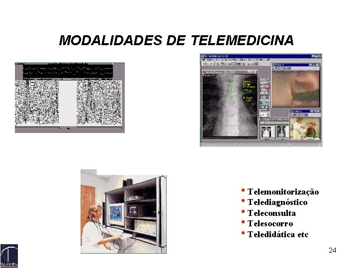 MODALIDADES DE TELEMEDICINA • Telemonitorização • Telediagnóstico • Teleconsulta • Telesocorro • Teledidática etc