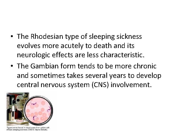  • The Rhodesian type of sleeping sickness evolves more acutely to death and