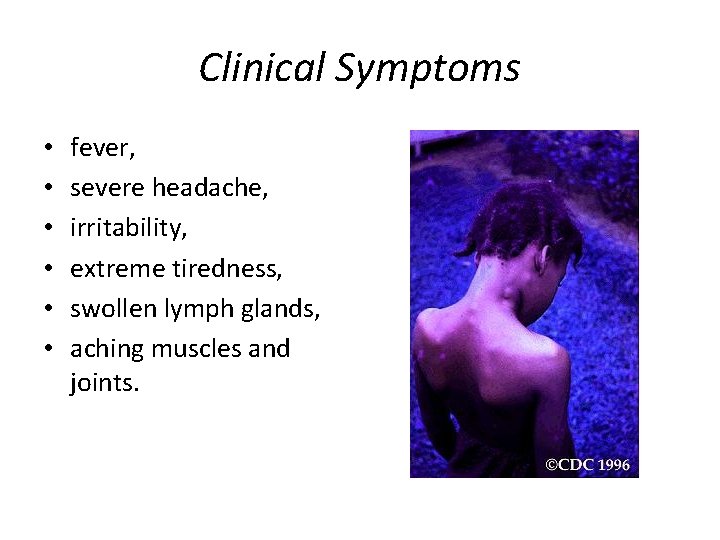 Clinical Symptoms • • • fever, severe headache, irritability, extreme tiredness, swollen lymph glands,