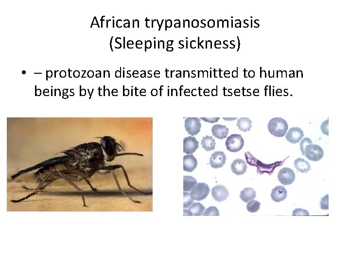 African trypanosomiasis (Sleeping sickness) • – protozoan disease transmitted to human beings by the