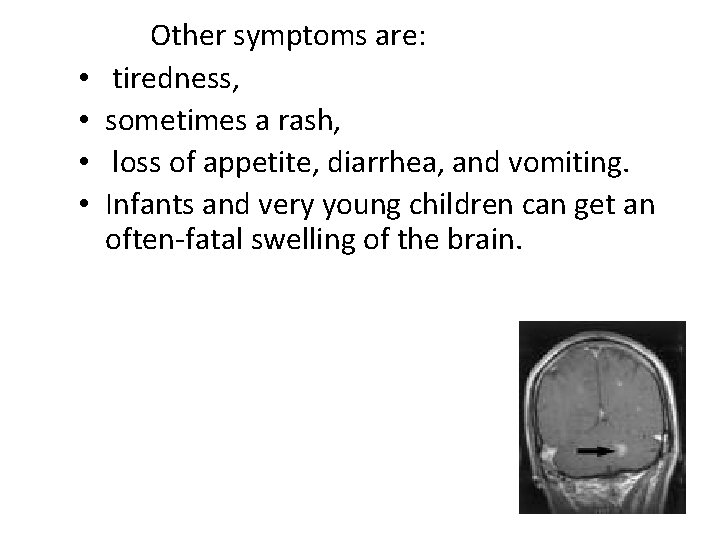  • • Other symptoms are: tiredness, sometimes a rash, loss of appetite, diarrhea,