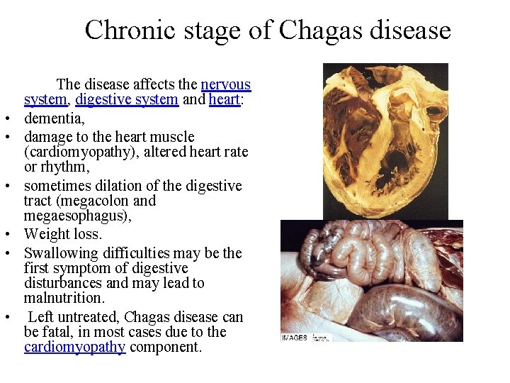 Chronic stage of Chagas disease • • • The disease affects the nervous system,