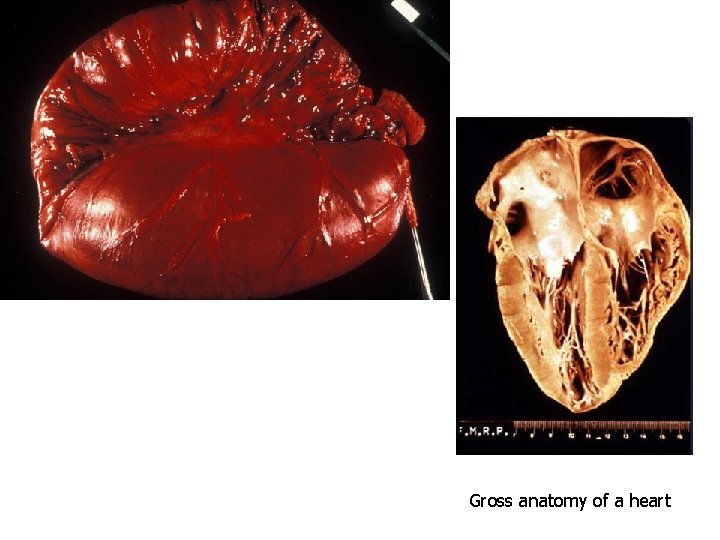 Gross anatomy of a heart 