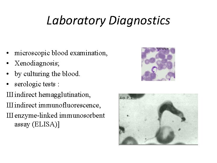 Laboratory Diagnostics • microscopic blood examination, • Xenodiagnosis; • by culturing the blood. •