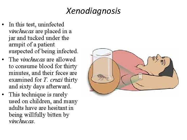 Xenodiagnosis • In this test, uninfected vinchucas are placed in a jar and tucked