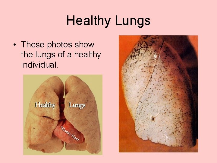 Healthy Lungs • These photos show the lungs of a healthy individual. 