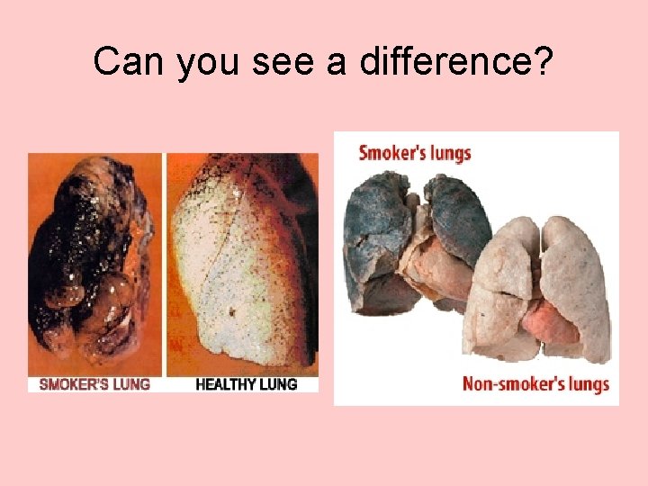 Can you see a difference? 