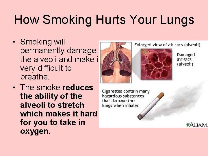 How Smoking Hurts Your Lungs • Smoking will permanently damage the alveoli and make