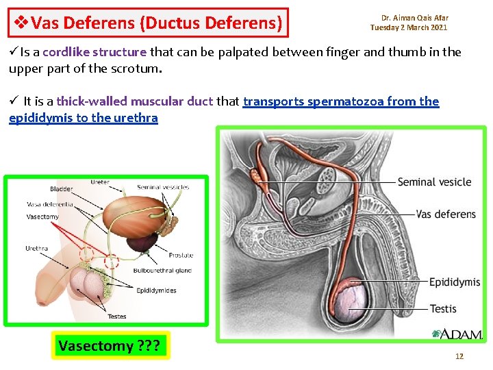 v. Vas Deferens (Ductus Deferens) Dr. Aiman Qais Afar Tuesday 2 March 2021 üIs