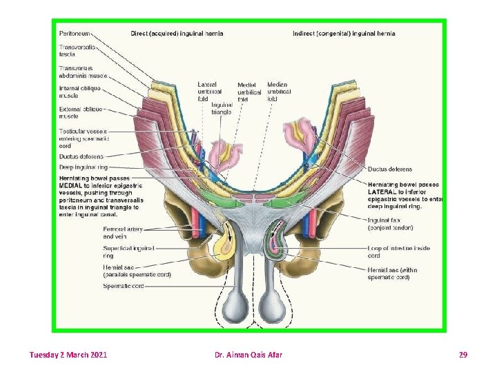 Tuesday 2 March 2021 Dr. Aiman Qais Afar 29 