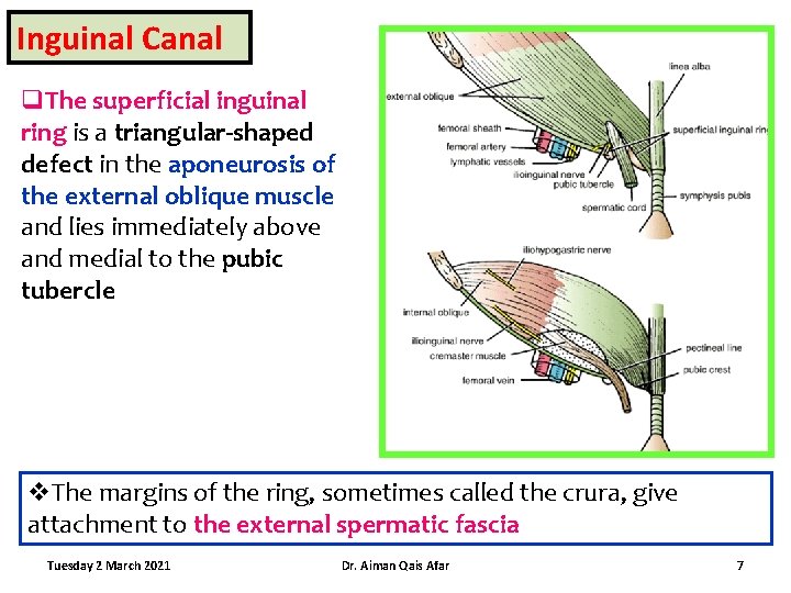 Inguinal Canal q. The superficial inguinal ring is a triangular-shaped defect in the aponeurosis