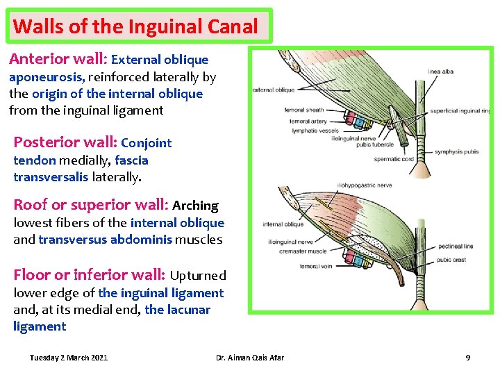 Walls of the Inguinal Canal Anterior wall: External oblique aponeurosis, reinforced laterally by the