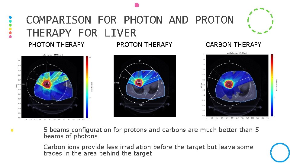 COMPARISON FOR PHOTON AND PROTON THERAPY FOR LIVER PHOTON THERAPY PROTON THERAPY CARBON THERAPY