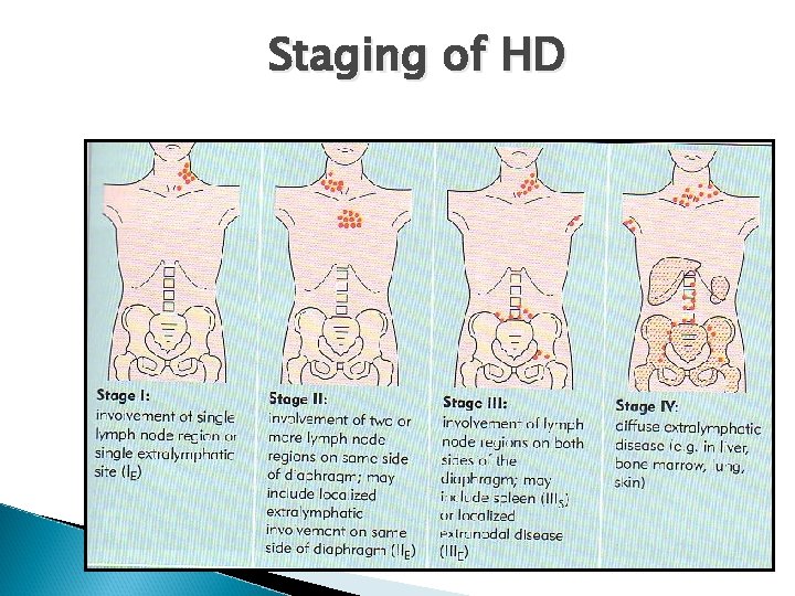 Staging of HD 