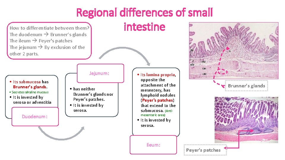 Regional differences of small How to differentiate between them? intestine The duodenum Brunner’s glands