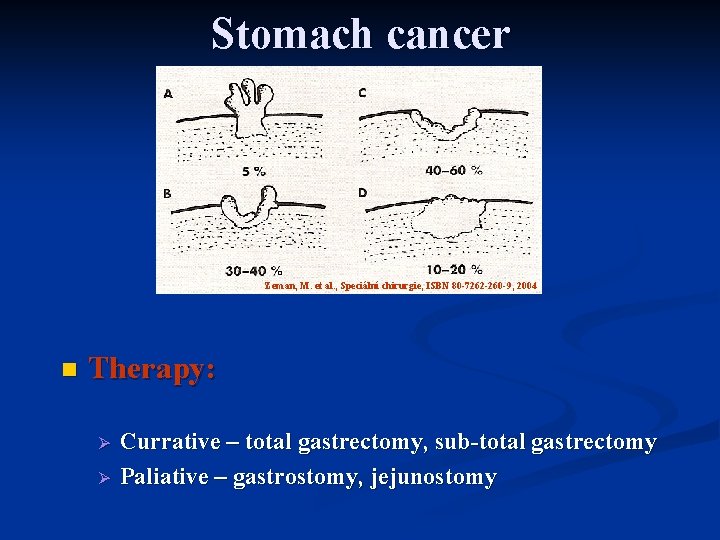 Stomach cancer Zeman, M. et al. , Speciální chirurgie, ISBN 80 -7262 -260 -9,
