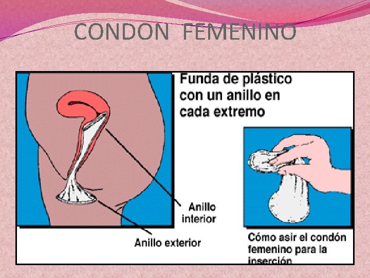 CONDON FEMENINO 