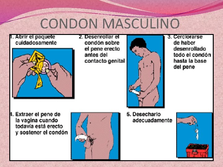 CONDON MASCULINO 