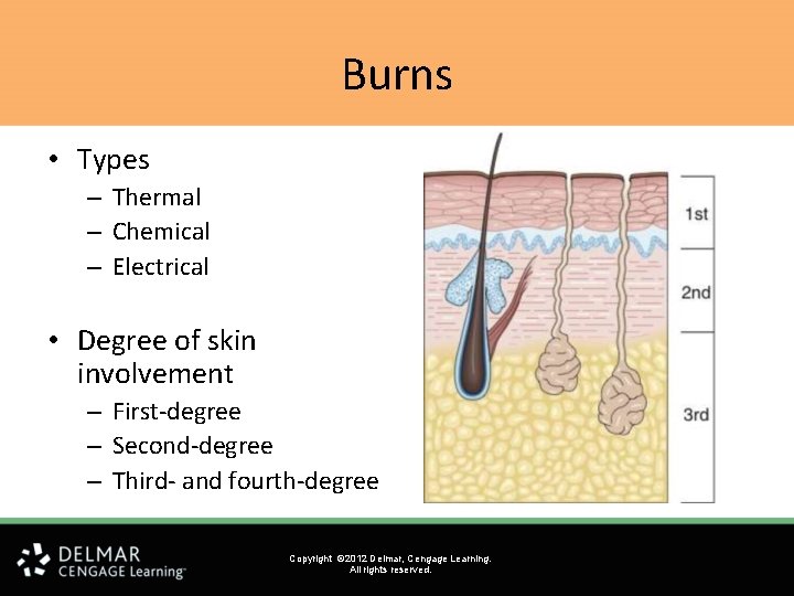 Burns • Types – Thermal – Chemical – Electrical • Degree of skin involvement