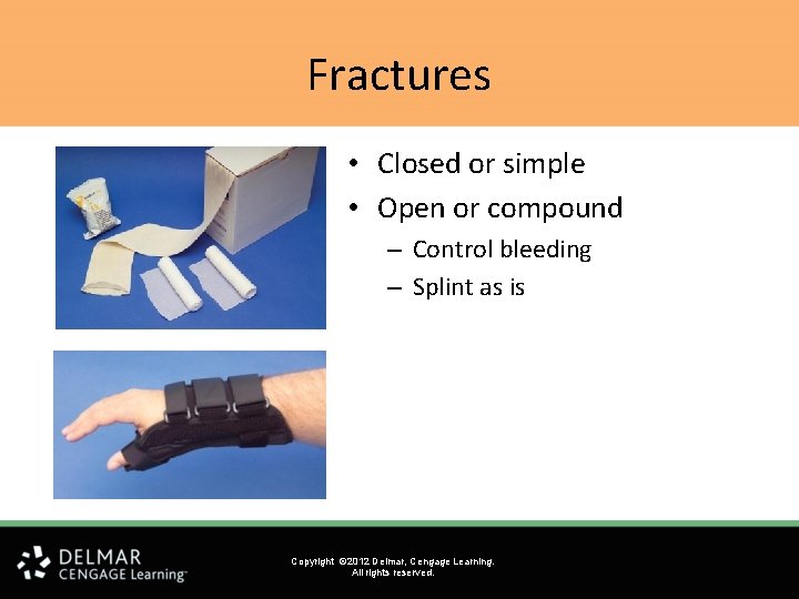 Fractures • Closed or simple • Open or compound – Control bleeding – Splint