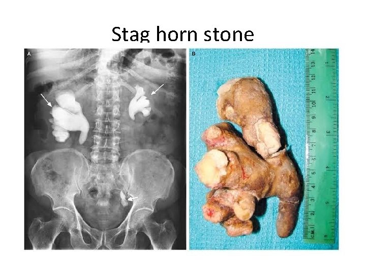 Stag horn stone 