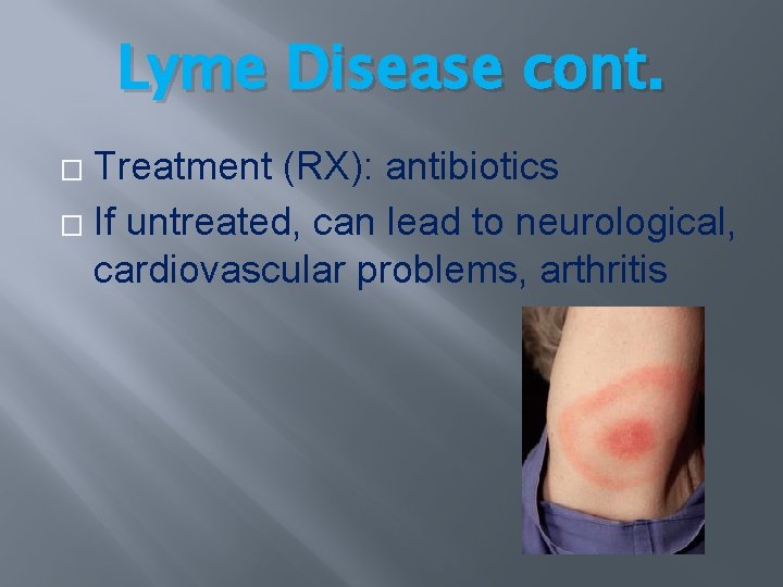 Lyme Disease cont. Treatment (RX): antibiotics � If untreated, can lead to neurological, cardiovascular Lyme Disease cont. Treatment (RX): antibiotics � If untreated, can lead to neurological, cardiovascular