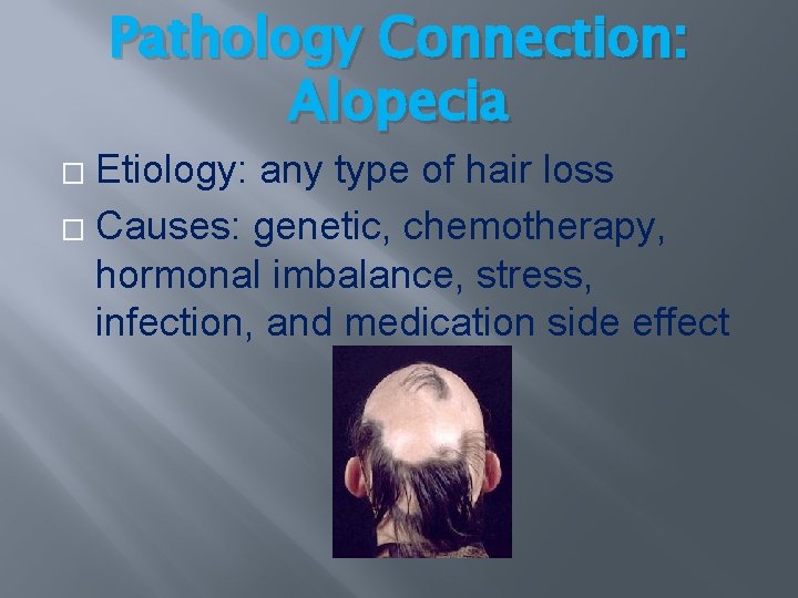 Pathology Connection: Alopecia Etiology: any type of hair loss � Causes: genetic, chemotherapy, hormonal Pathology Connection: Alopecia Etiology: any type of hair loss � Causes: genetic, chemotherapy, hormonal