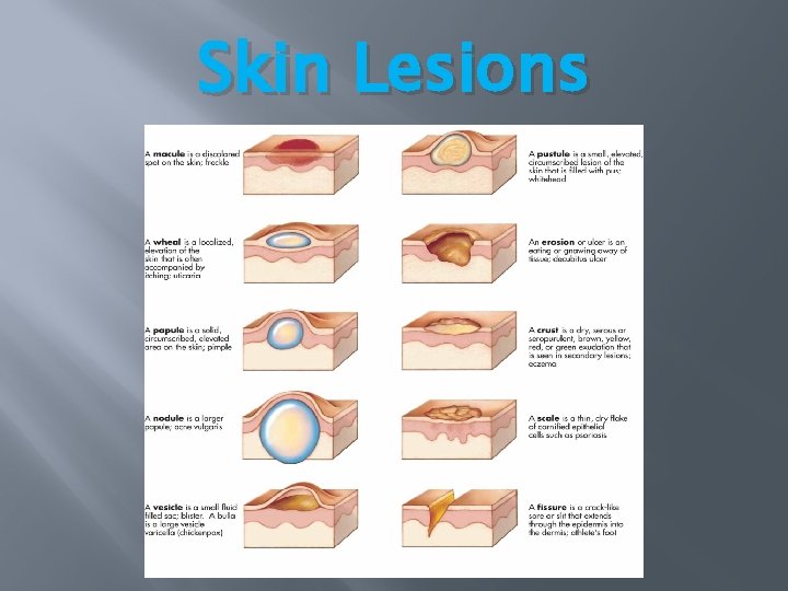 Skin Lesions Skin Lesions