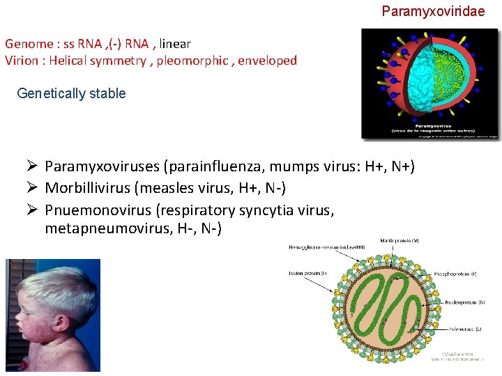 Paramyxoviridae Genome : ss RNA , (-) RNA , linear Virion : Helical symmetry