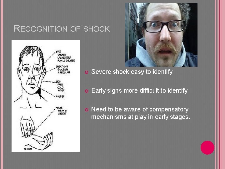 ASSESSMENT CIRCULATORY SHOCK SDMH EMC 2015 OBJECTIVES Understand
