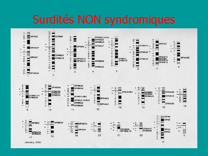 Surdités NON syndromiques 