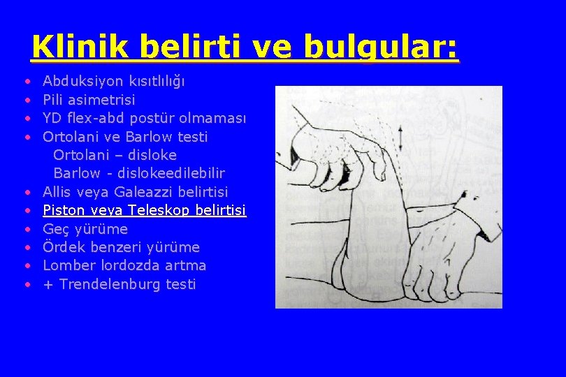 Klinik belirti ve bulgular: • • • Abduksiyon kısıtlılığı Pili asimetrisi YD flex-abd postür