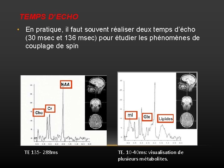 TEMPS D’ECHO • En pratique, il faut souvent réaliser deux temps d’écho (30 msec